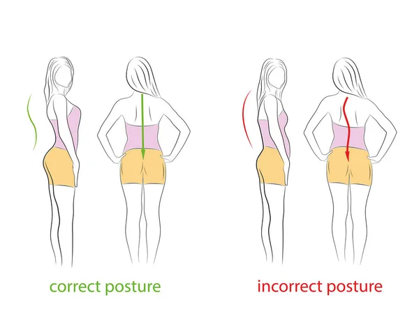 Postura Correta Incorreta Vista Lateral Traseira Recomendações Médicas Ilustração Vetorial — Vetor de Stock