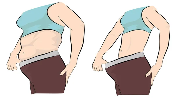 Frauenkörper Vor Und Nach Der Gewichtsabnahme Vektorillustration — Stockvektor