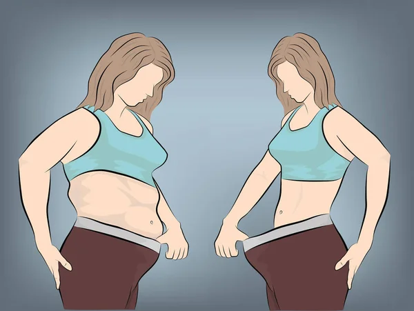 Женское Тело После Потери Веса Векторная Иллюстрация — стоковый вектор