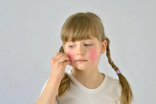 Çocuk, çocuk, Kuru cilt Diyatez vardır