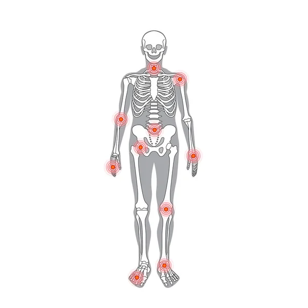Parti del corpo del vettore del dolore articolare con anello del dolore — Vettoriale Stock