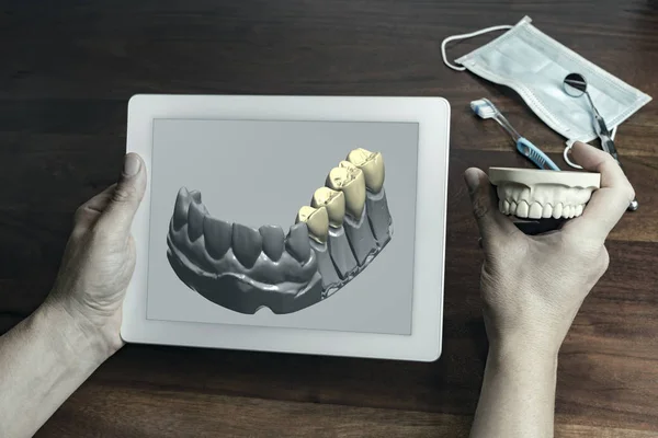 Unbekannte Halten Tablette Die Dreidimensionale Darstellung Falscher Weißer Zähne Zeigt — Stockfoto