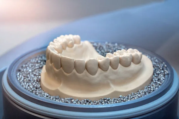 Stampo Gesso Della Mascella Inferiore Dei Denti Concetto Cura Dentale — Foto Stock