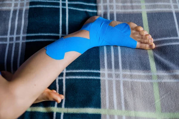 Elastische therapeutische blauwe tape toegepast op patiënten linkerbeen. — Stockfoto