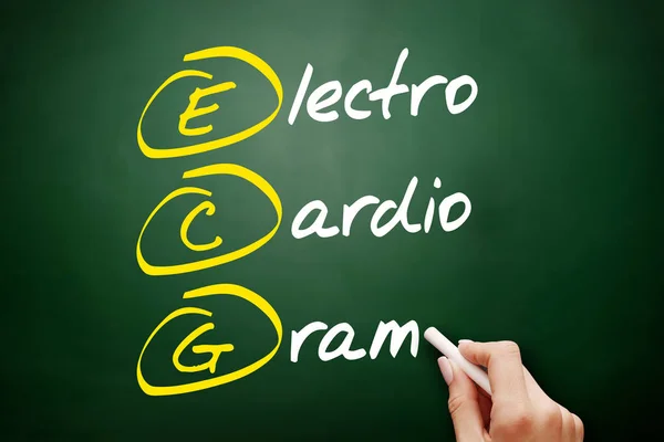 ECG - acrônimo de eletrocardiograma — Fotografia de Stock