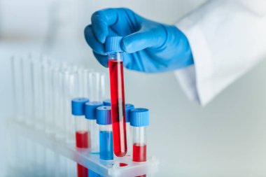 Elinde bir tüp ile laborant.