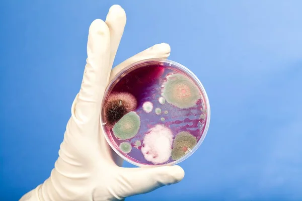 Mão Dos Cientistas Segurando Placa Petri Com Bactérias — Fotografia de Stock