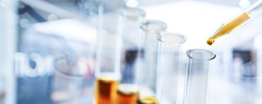 Cam laboratuvar şişeler ışık arka plan üzerinde 