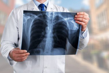 Doktor tarama x-ray ile.