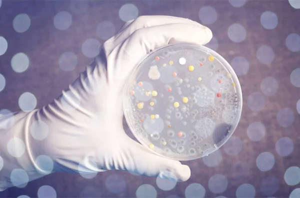 Mão Dos Cientistas Segurando Placa Petri Com Bactérias — Fotografia de Stock