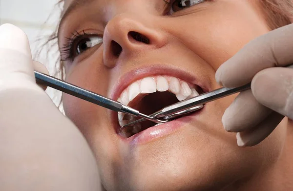 Woman teeth and a dentist mouth mirror — Stock Photo, Image