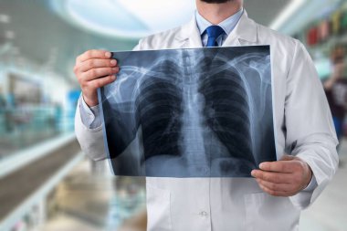 x-ışını insan meme tutan genç doktor erkek portresi