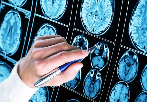 Magnetic Resonance Scan Brain Mri Head Scan Medicine Science — Stock Photo, Image