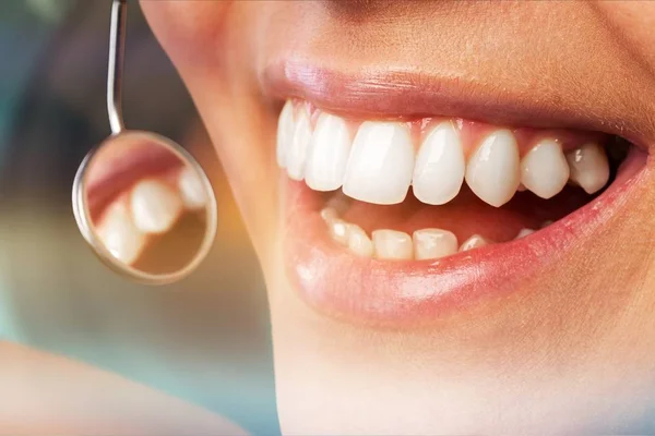 Γυναικεία δόντια και οδοντίατρος καθρέφτης στόματος — Φωτογραφία Αρχείου