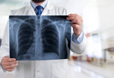 Doktor röntgende arka plan bulanık incelenmesi 