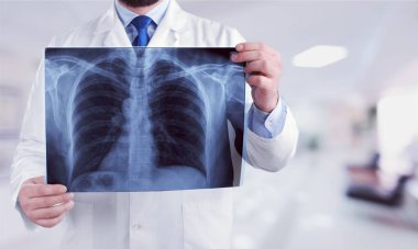 Doktor röntgende arka plan bulanık incelenmesi 