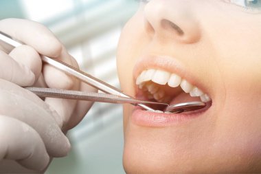 diş kliniğinde diş hekimi muayene dişleri