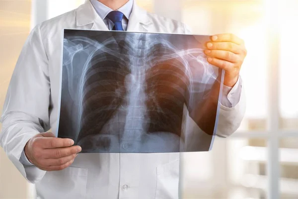 stock image Doctor look x-ray ray x tuberculosis hospital pneumonia doctor
