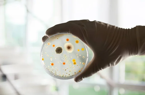 Επιστήμονες Του Χέρι Που Κρατά Τρυβλίο Petri Βακτήρια — Φωτογραφία Αρχείου