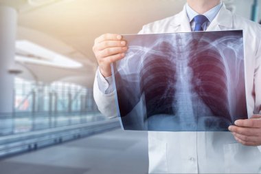 Doktor röntgende arka plan bulanık incelenmesi 