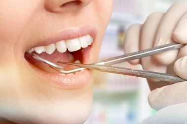 diş kliniğinde diş hekimi muayene dişleri