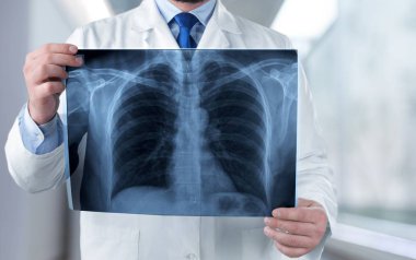 Doktor röntgende arka plan bulanık incelenmesi 