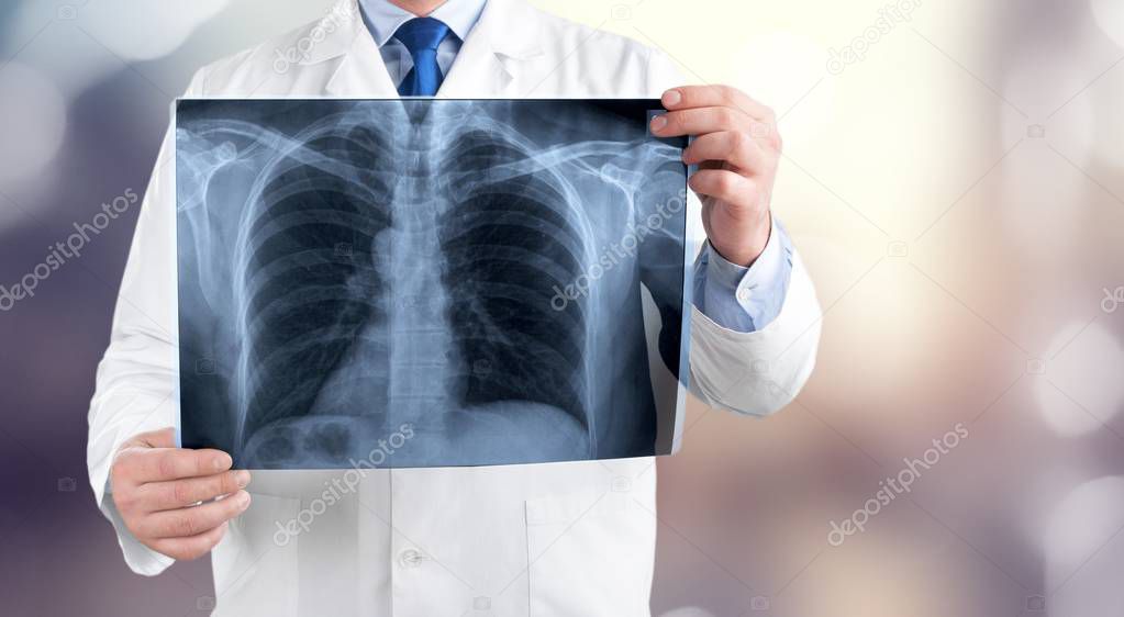 Doctor examining x-ray on blurred background 