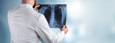 Erkek doktor holding x-ray