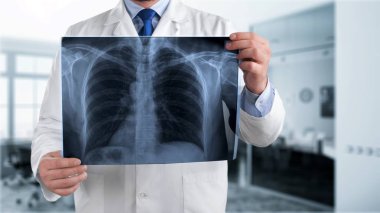 Doktor röntgende arka plan bulanık incelenmesi  