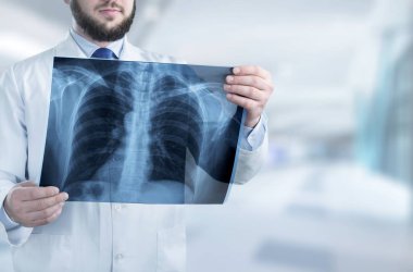 Doktor röntgende arka plan bulanık incelenmesi 
