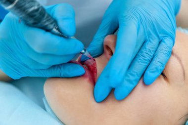 Güzellik uzmanı, dudaklarından kalıcı makyaj uygulanır. Dudak dövme