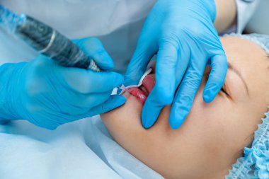 Güzellik uzmanı, dudaklarından kalıcı makyaj uygulanır. Dudak dövme