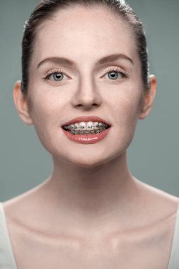 Genç kız dişlerini diş telleri ile fotoğraf makinesi üzerinde gösterir.