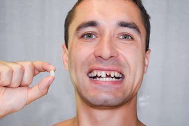 Dental prosthesis of metal ceramics in the hand of a man without a tooth. A patient without a tooth is trying on a denture. Tooth implantation, dental treatment. clipart