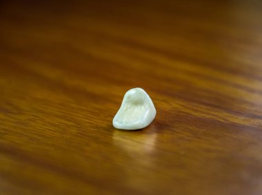 Diş, metal seramik taç masanın üzerinde. Takma diş metal seramik ürünler.