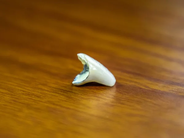 Δόντι Μεταλλικά Κεραμικό Στέμμα Πάνω Στο Τραπέζι Οδοντοστοιχία Που Κατασκευάζονται — Φωτογραφία Αρχείου