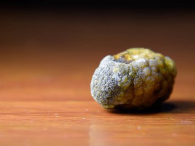 Büyük safra taşı, safra kesesi taşı. Safra taşlarının sonucu