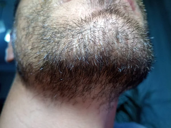 Joven barbudo, rastrojo cerca. Sin afeitar más de una semana. —  Fotos de Stock