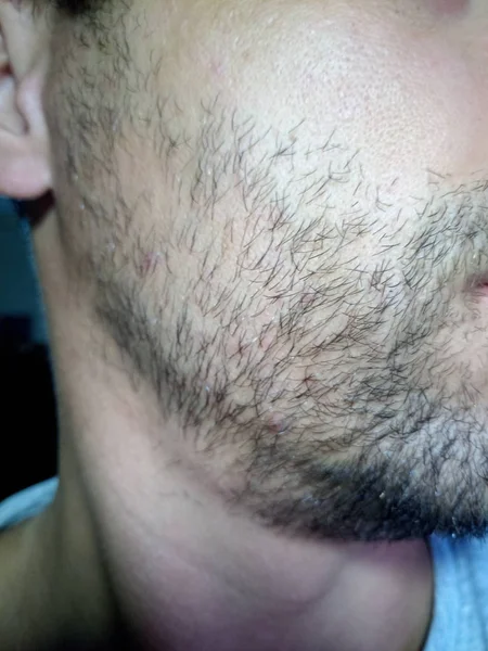 Jovem barbudo, restolho perto. Unshaven mais de uma semana. — Fotografia de Stock
