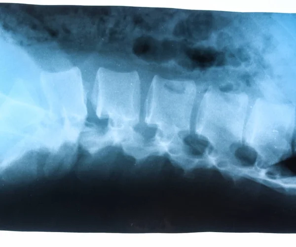 腰椎的X射线,X射线的脊柱 — 图库照片