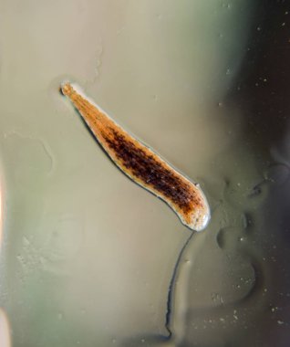 Cama sülük. Kan emici hayvan. Kemer-türü sınıfından ringworms alt sınıfı. Hirudotherapy