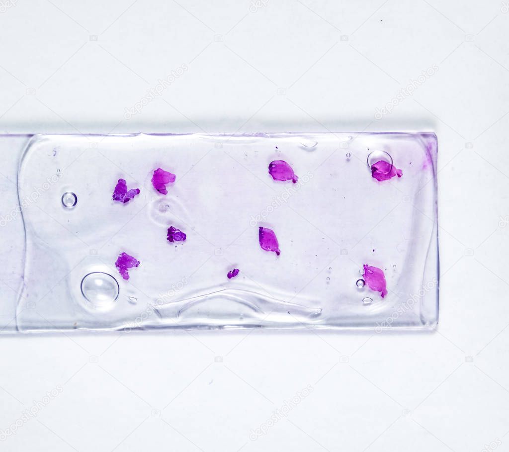 Slices of the tumor under glass. Histological examination of tumor cells for the presence of cancer