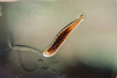 Cama sülük. Kan emici hayvan. Kemer-türü sınıfından ringworms alt sınıfı. Hirudotherapy