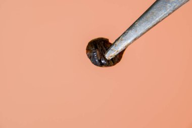 Cımbız üzerinde sülük. Kan emici hayvan. Kemer-türü sınıfından ringworms alt sınıfı. Hirudotherapy