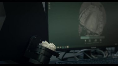 Çenenin alçı kalıbının 3 boyutlu taraması. Modern diş teknolojisi. Ultraviyole ışınları dişlerin arasından geçer. Ekranda 3D model.