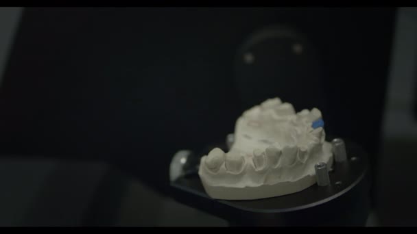 3D scanning van een gipsafdruk van de kaak. Moderne tandheelkundige technologie. Ultraviolette stralen reizen door de tanden — Stockvideo