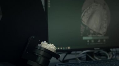 Çenenin alçı kalıbının 3 boyutlu taraması. Modern diş teknolojisi. Ultraviyole ışınları dişlerin arasından geçer. Ekranda 3D model.