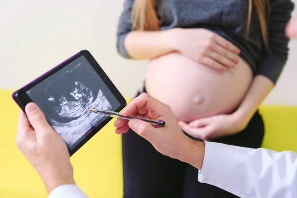 Ginecólogo Mostrando Foto Eco Mujer Embarazada —  Fotos de Stock