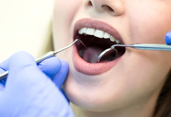 Close Picture Young Woman Sitting Dentist Chair Opened Mouth Dentist — Stock Photo, Image