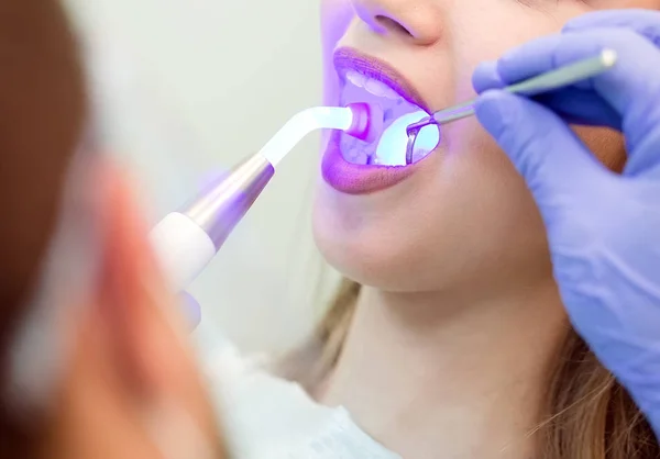 Dentist Doing Procedure Dental Curing Light Clinic — Stock Photo, Image